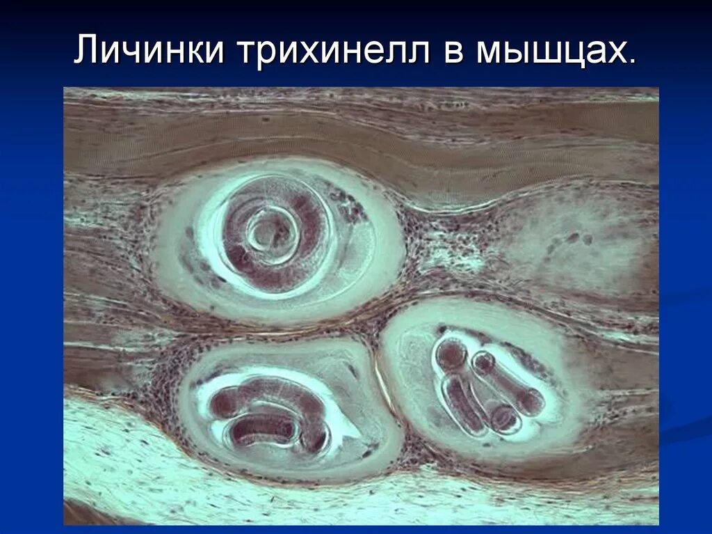 Мышечный червь