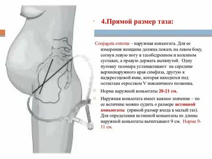 Размеры выхода таза