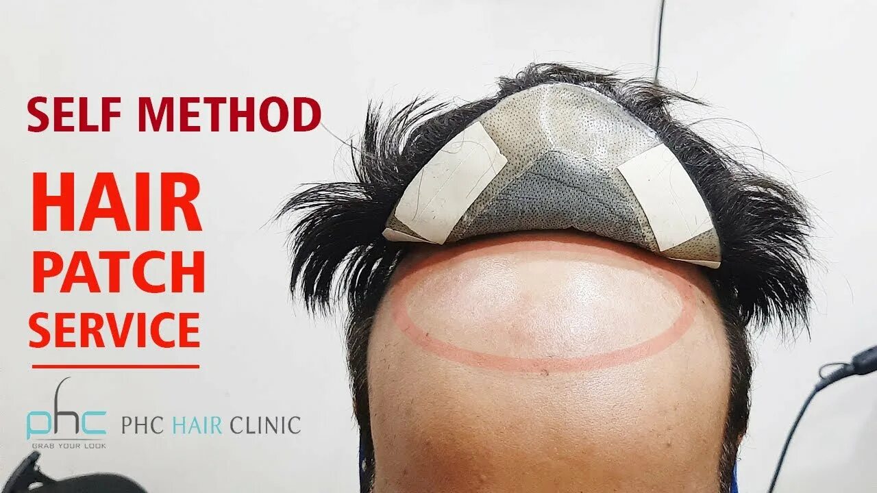 Self method. Patch волосы. Патчи для волос. Hair Patch in Makhachkala.