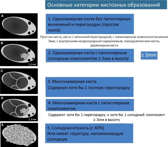 Киста яичника o rads