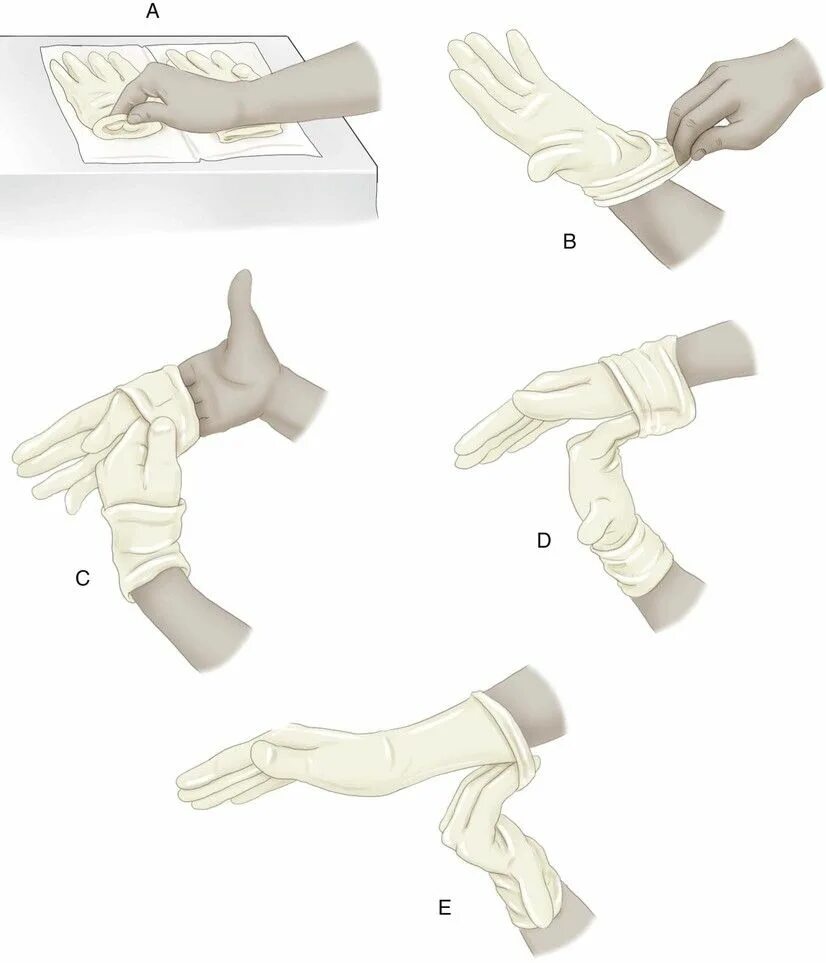 Стерильные перчатки. Техника одевания стерильных перчаток. Снятие стерильных перчаток алгоритм. Медицинские перчатки алгоритм надевания. Надевать стерильные перчатки в случаях