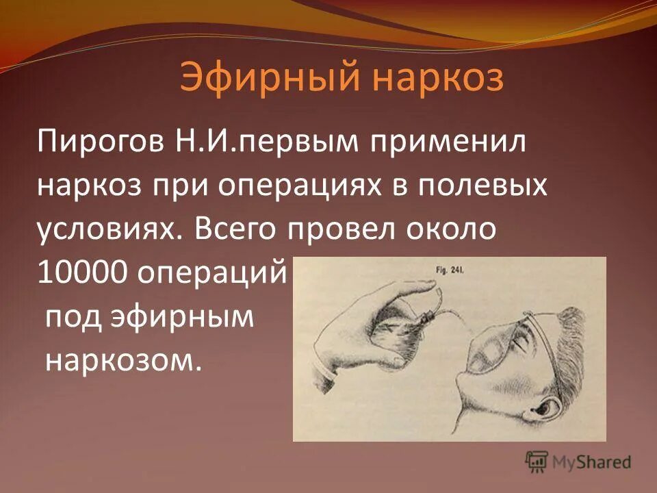н. первое применение анестезии. стадии эфиреого нареоща. пирогов операция под наркозом. 2 стадия эфирного наркоза.