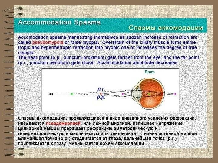 Спазм аккомодации мышцы. Миопия и спазм аккомодации. Спазм аккомодации хрусталика. Аккомодация механизм аккомодации спазм аккомодации. Причины аккомодации