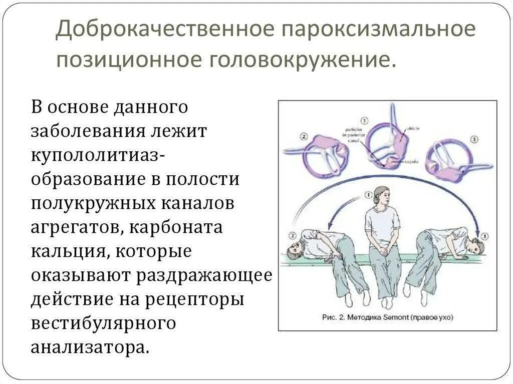 Кружится голова в положении лежа при повороте