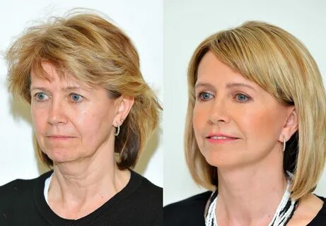 После смаса что нельзя делать