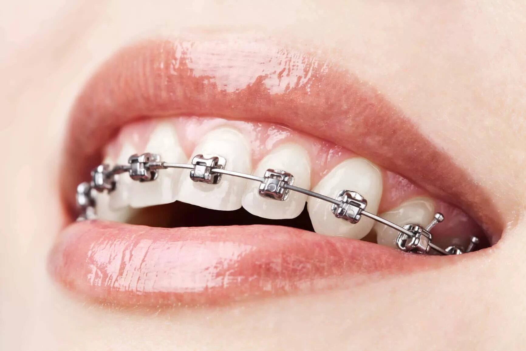 Bracket language. Bracket language