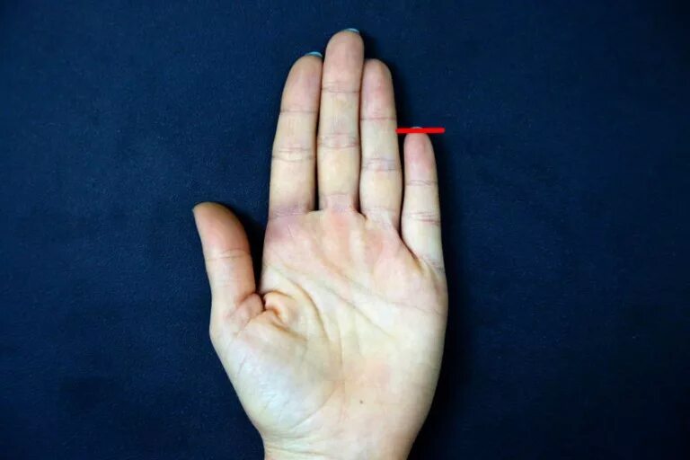 отсутствие указательного пальца. перелом костяшки пальца мизинца. безымянный палец. отсутствие указательного пальца. отсутствие указательного пальца.