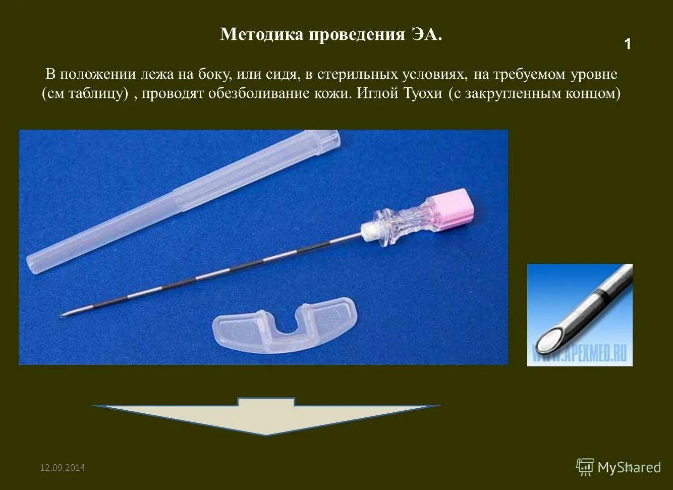 Игла для эпидуральной анестезии туохи 18g. Игла для эпидуральной анестезии туохи 18g. Игла для эпидуральной анестезии туохи 18g. Игла для эпидуральной анестезии 21g. Игла туохи эпидуральная 18g 80 мм.