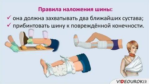 Первая помощь при переломах ушибах и вывихах