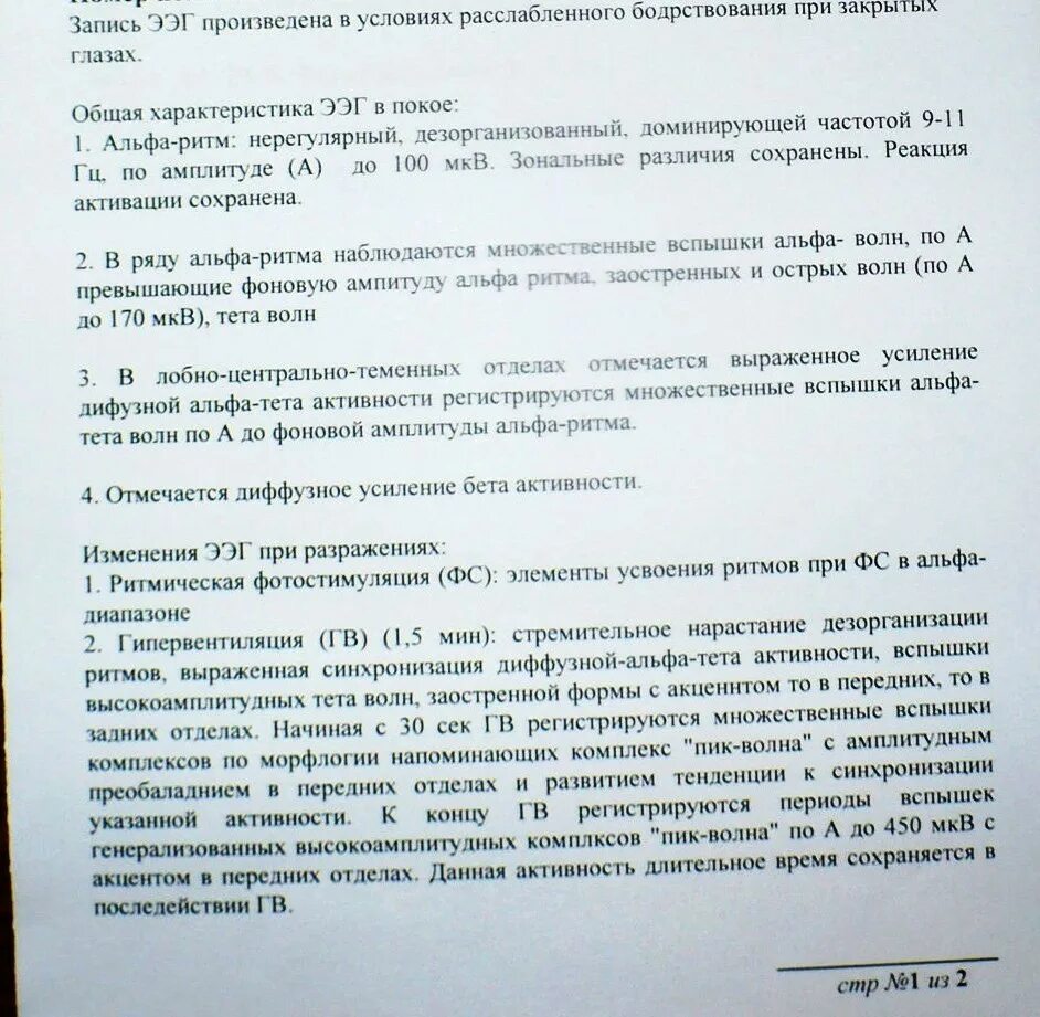 Дезорганизация головного мозга что это. ЭЭГ И УЗДГ. Пик волна на ЭЭГ. Фоновая ЭЭГ дезорганизованного типа. Дезорганизация Альфа ритма на ЭЭГ У ребенка.