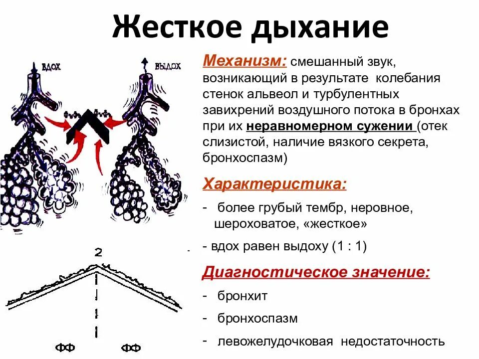 Сухие хрипы без кашля и температуры