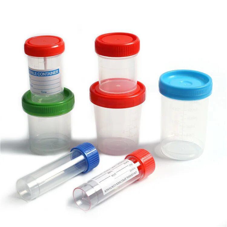 Подготовка к лабораторным методам исследования крови. Лабораторная посуда для сбора мочи. Исследование мочи кала мокроты. Исследование мочи кала мокроты. Анализ мокроты на бактериологическое исследование алгоритм.