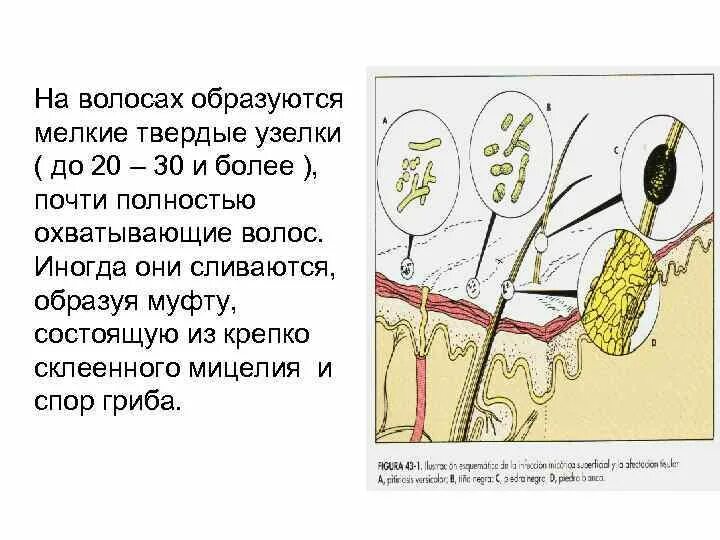 Почему появляются узлы. Узелки на волосах. Как появляются узелки на волосах. Почему на волосах появляются узелки. Почему появляются узлы на волосах.