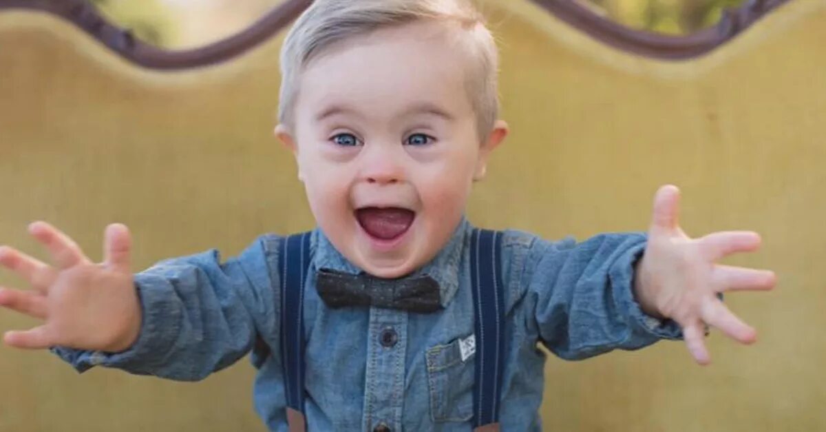 красивые младенцы с синдромом дауна. синдром дауна. занятия для детей даунов. развитие детей с синдромом дауна. занятие с ребенком дауном.