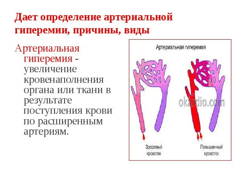 Причины артериальной гиперемии. Артериальная гиперемия определение. Нарушение периферического кровообращения артериальная гиперемия. Нейрогенная артериальная гиперемия.