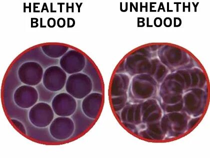 Living blood
