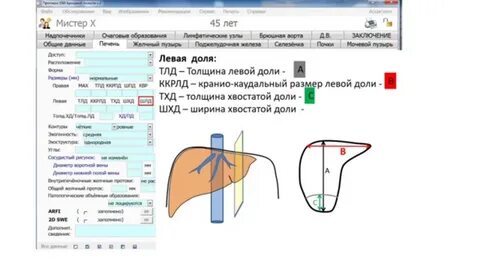 Размер хвостатой доли
