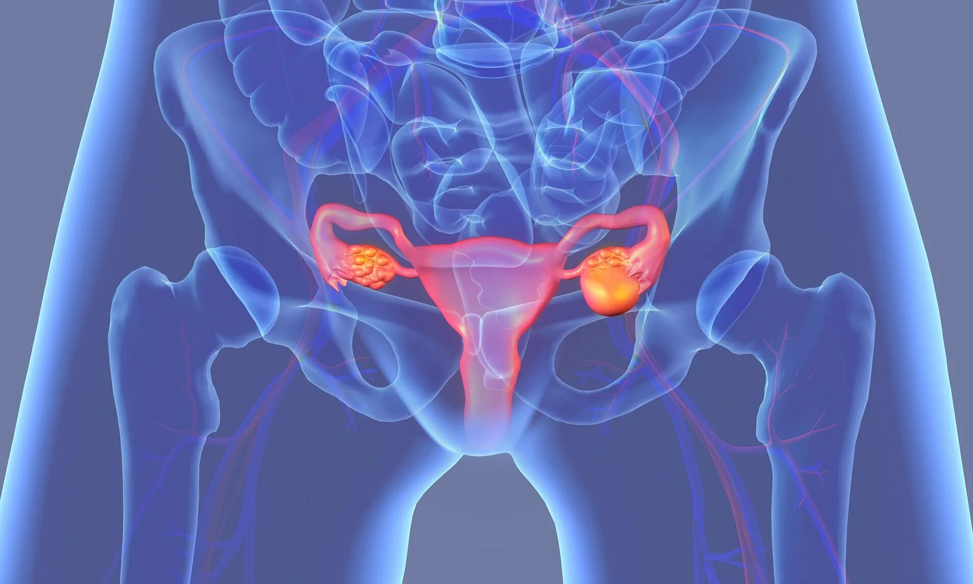 Функционирующий яичник. Опухоли яичников гинекология. Заболевания женской репродуктивной системы. Злокачественная опухоль яичника.