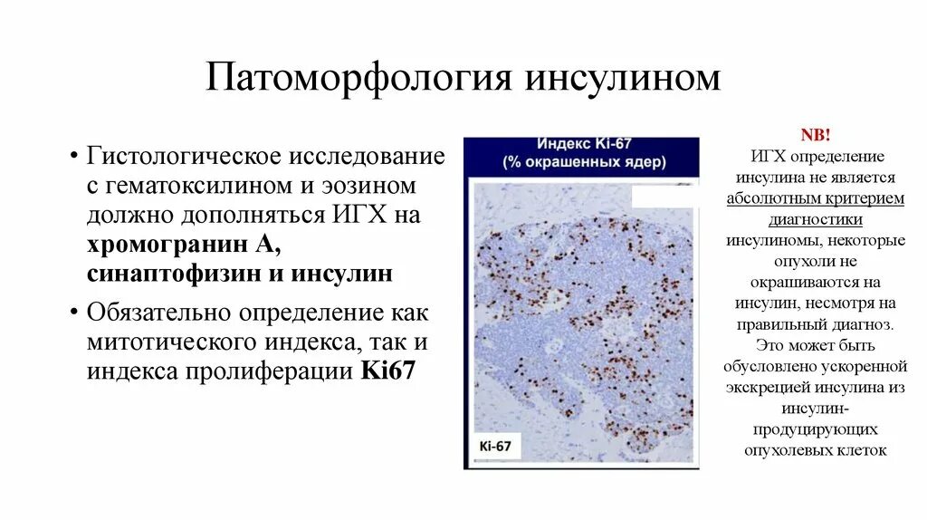 Иммуногистохимический анализ. ИГХ хромогранин. Патоморфологические исследования. Синаптофизин хромогранин. Иммуногистохимические маркеры