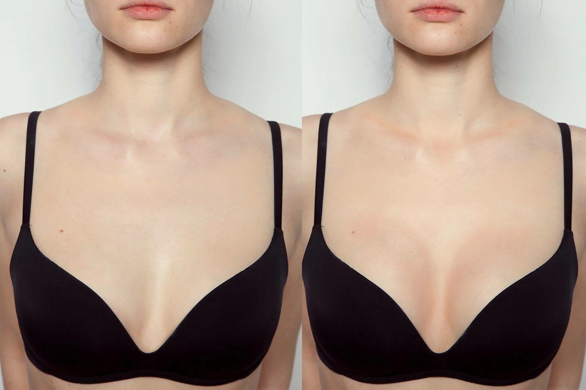 Увеличение грудных. Увеличение грудных. Увеличенная грудь. Маммопластика до после. Силиконовая грудь первого размера.