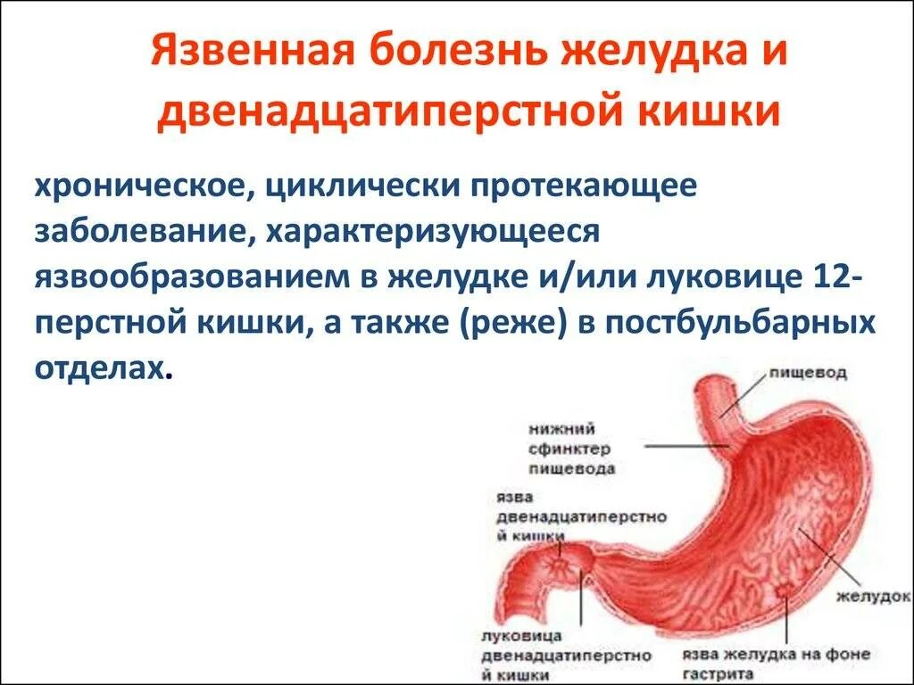 Причины появления язвы. Язвенная болезнь желудка и 12 перстной. Язвенная болезнь 12 перстной кишки кишки. Симптомы язвы желудка и 12-перстной кишки. Язва 12 перстной кишки симптомы.