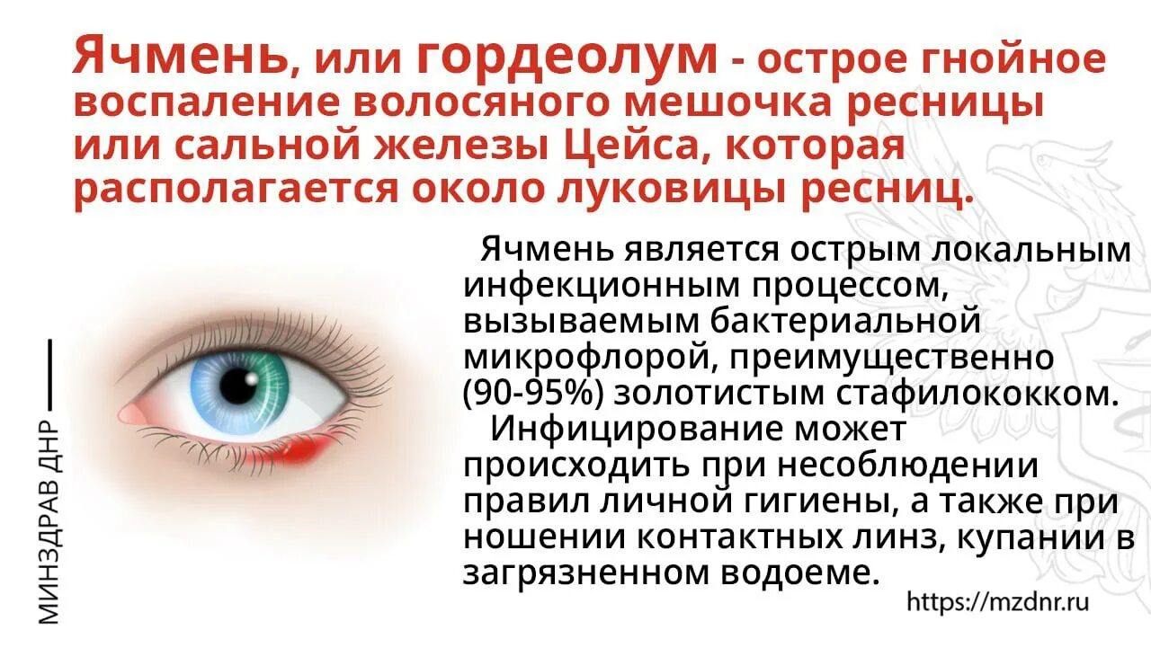 Развитие ячменя. Этапы развития ячменя на глазу. Ячмень на глазу презентация. Этапы формирования ячменя на глазу. Ячмень на глазу профилактика.