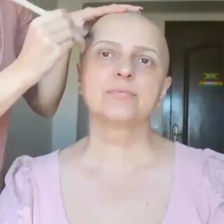 Выпали волосы после химиотерапии форум