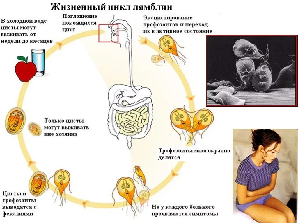 Жизненный цикл лямблии схема. Lamblia жизненный цикл. Жизненный цикл лямблии кишечной схема. Лямблия кишечная жизненный цикл.