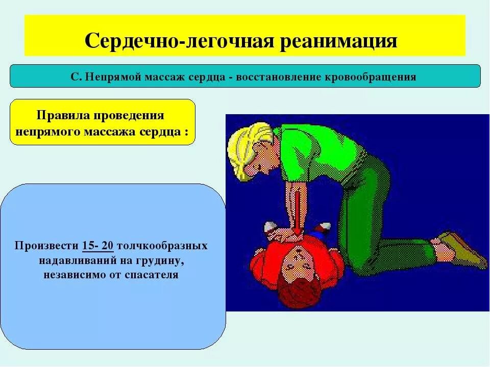 Частота надавливаний при проведении реанимации составляет. Сердечно-легочная реанимация 30 надавливаний. Сердечно-легочная реанимация (СЛР) таблица. Сердечно легочная реанимация непрямой массаж сердца. Сердечнотлегочная реанимация непрямой массаж сердца.