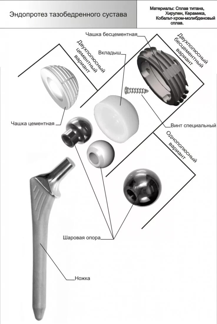 Эндопротез тазобедренного сес. Эндопротез тазобедренного сустава джонсон и джонсон. Эндопротезы классификация. Sanatmetal эндопротез тазобедренного сустава. Двухполюсный протез тазобедренного сустава.