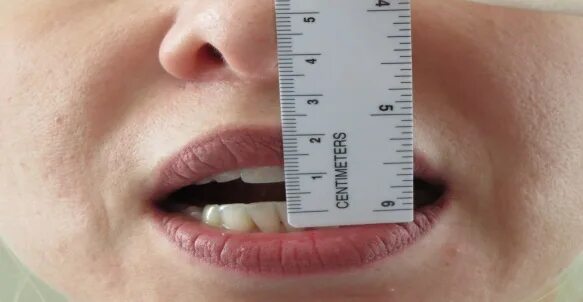 Насколько широко. Ограничение открывания рта. Степень открывания рта. Измерение ширины открывания рта. Степень открывания р а.