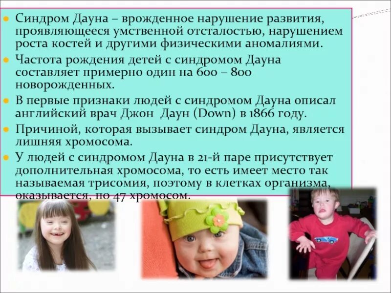 Синдром дауна интеллект. Синдром дауна. дети с синдромом дауна. развитие детей даунов. развитие детей с синдромом дауна.