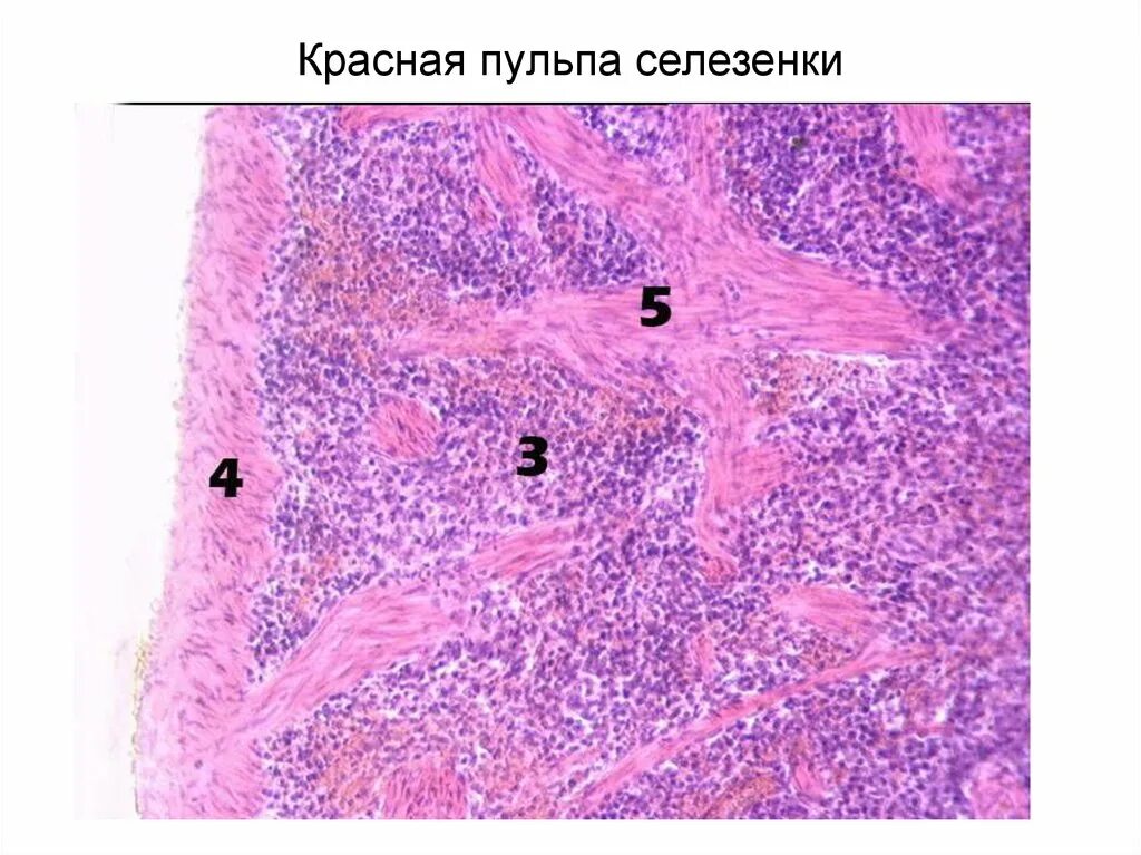 Красная пульпа селезенки