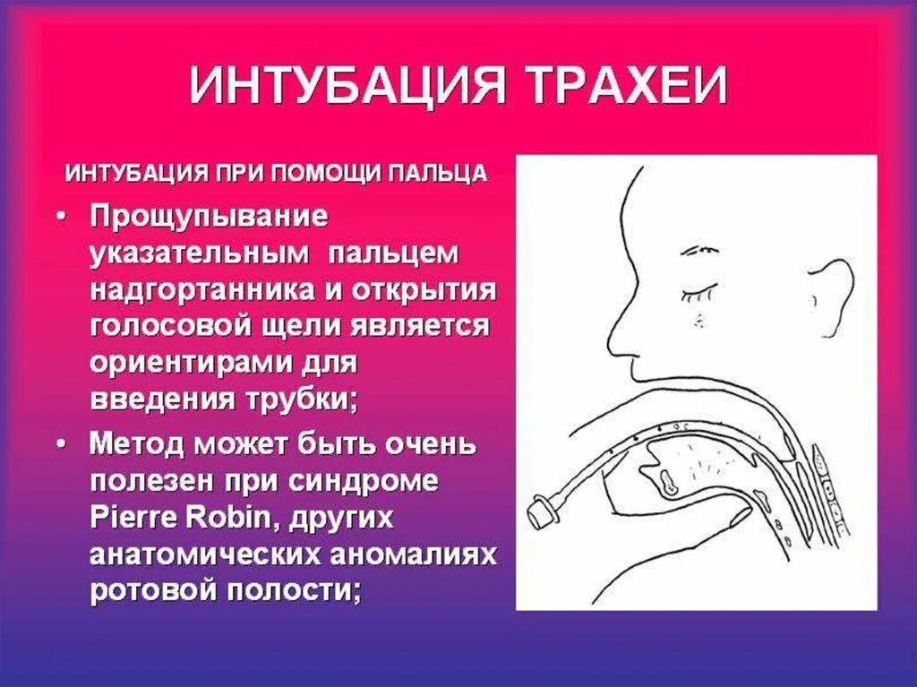 Для интубации трахеи необходим. Голосовая щель при интубации трахеи. техника интубации трахеи. интубация трахеи ориентиры.