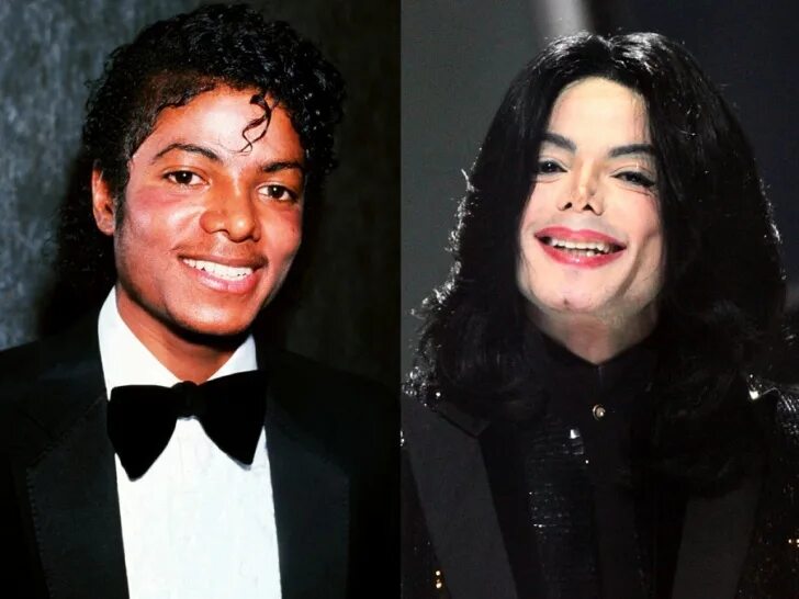 Janet Jackson Plastic Surgury