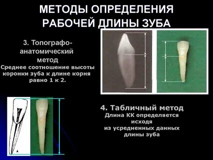 Длина рабочих ходов