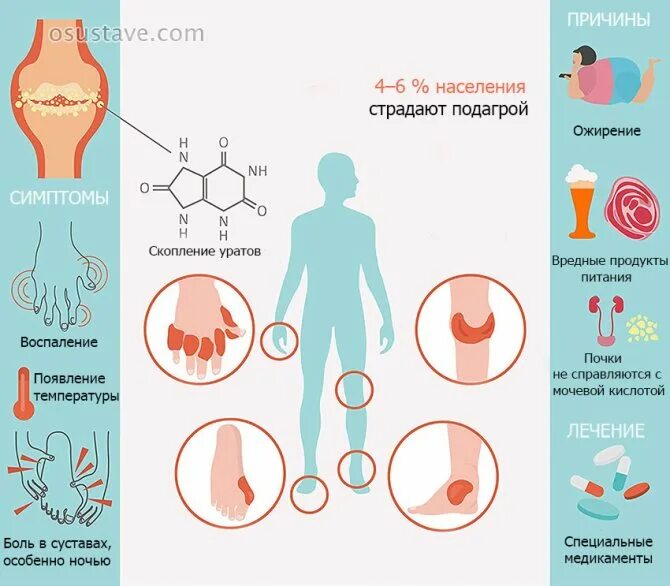 Подагра к какому врачу обращаться женщине. Проявления подагра клинические симптомы. Медикаментозная терапия подагры. Подагра что это за болезнь симптомы лечение. Подагра лечение.