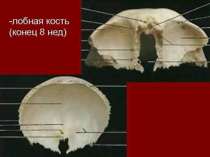 Размер лобной кости. Строение лобной кости черепа. Лобная кость черепа анатомия. Os frontale анатомия. Лобная кость синельников.