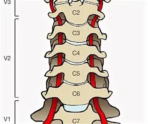Гипоплазия позвоночной артерии. Сегмент v 4. Аплазия позвоночной артерии. Сегменты вертебральной артерии. Сегмент v 4.