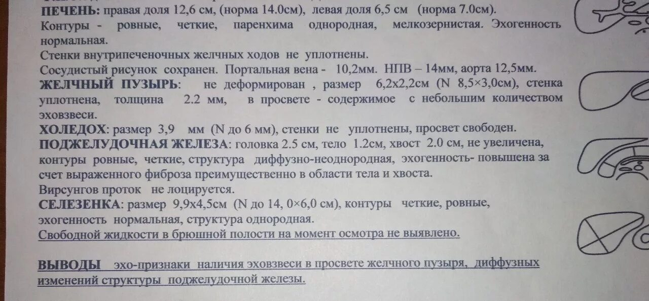 Поджелудочная железа узи норма у мужчин. Показатели печени при УЗИ норма. Исследование печени УЗИ норма. УЗИ печени Результаты нормы. Печень УЗИ расшифровка норма у взрослых.