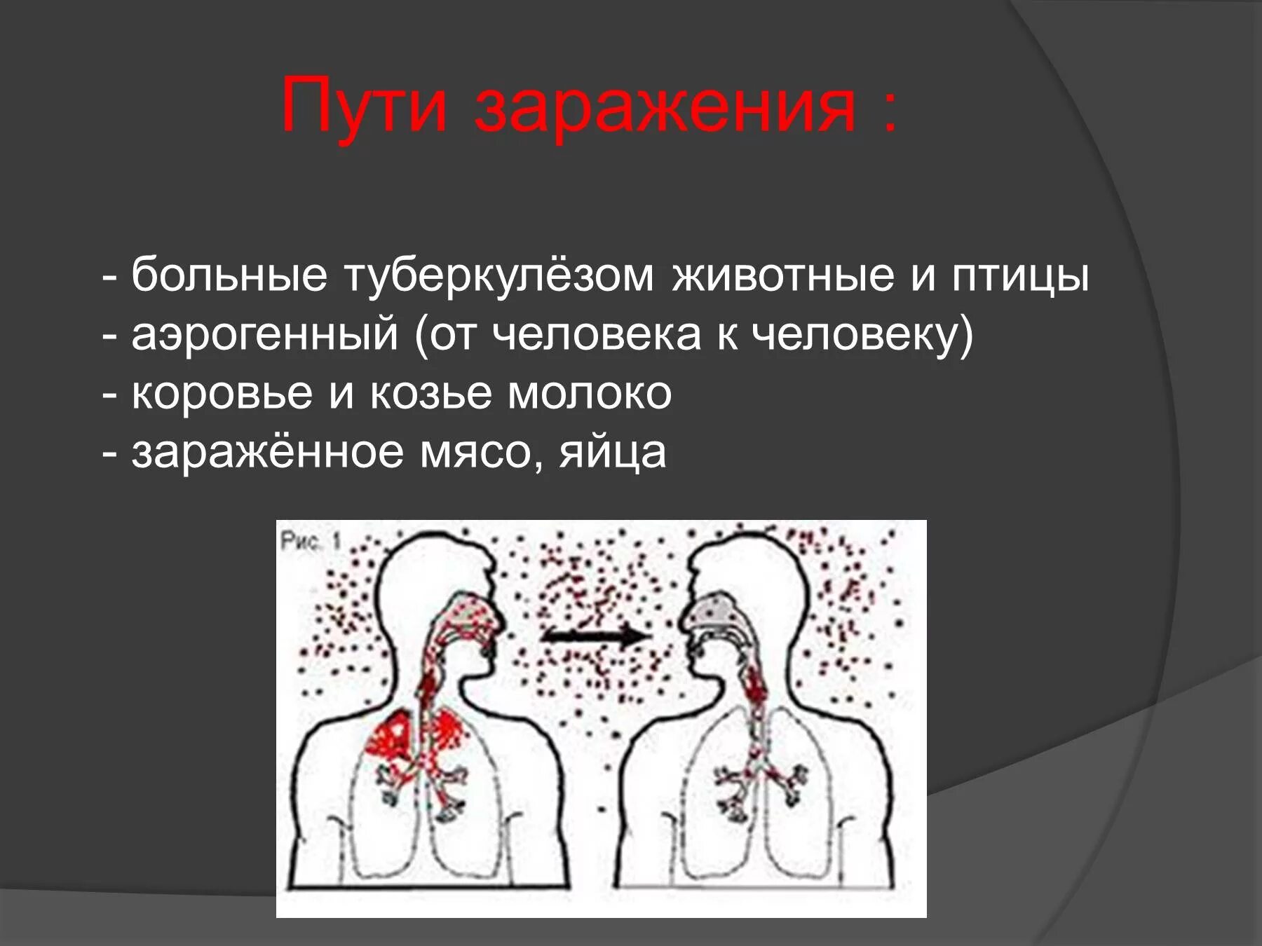 Туберкулез рассказать