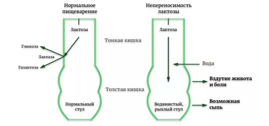 Лактоза усваивается организмом. Лактазная недостаточность биохимия схема. Причины непереносимости молока биохимия. Непереносимость лактозы биохимия. Причины нарушения переваривания лактозы.