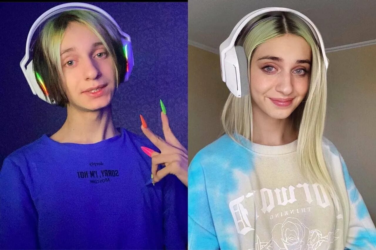 Китайки до и после пластики. Корейка после операции. Корейка после операции. Корейка после операции. Корейка после операции.