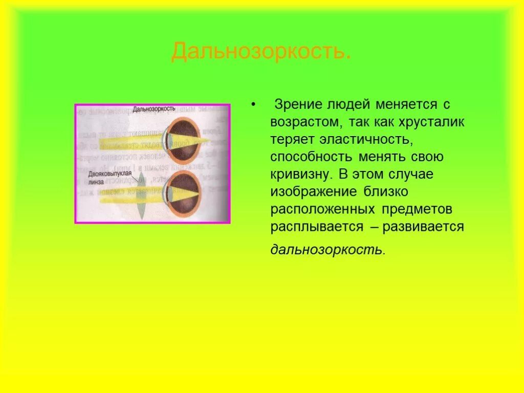 Расплывчатое изображение близкорасположенных предметов