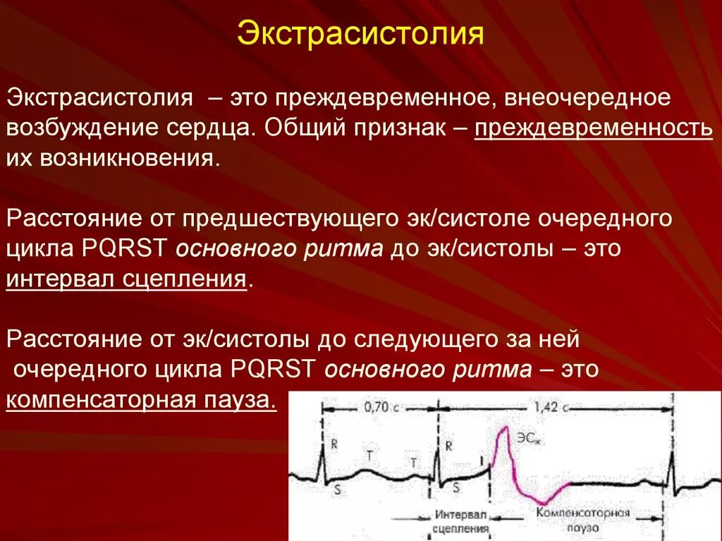 Эктопическая экстрасистола