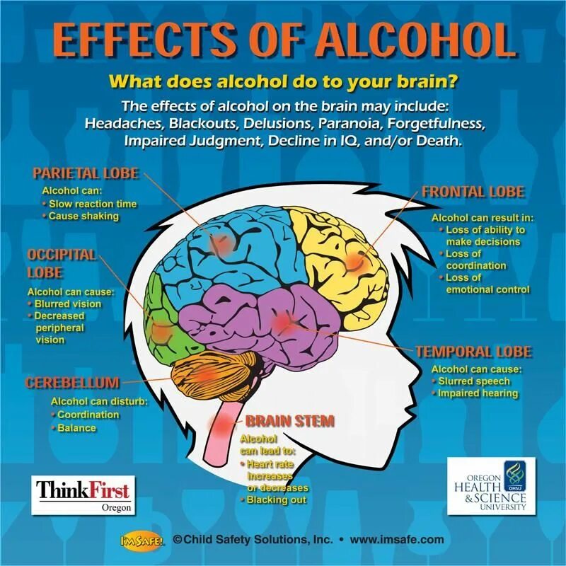 Головной мозг и алкоголь. Influence of alcohol on Brain. Brain effect