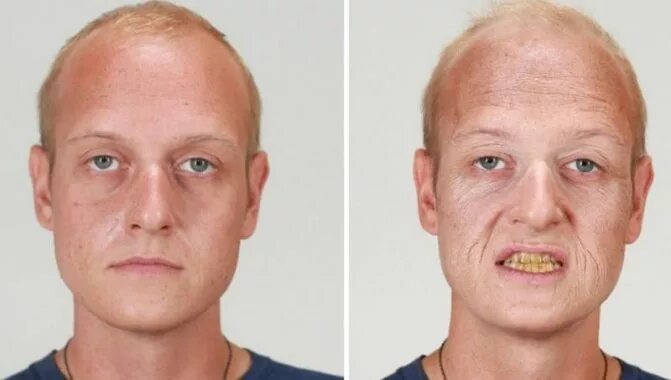Рак после 40 лет. Люди до и после курения сигарет. Лицо человека до и после курения.