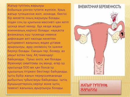 Жақсы анальный порно