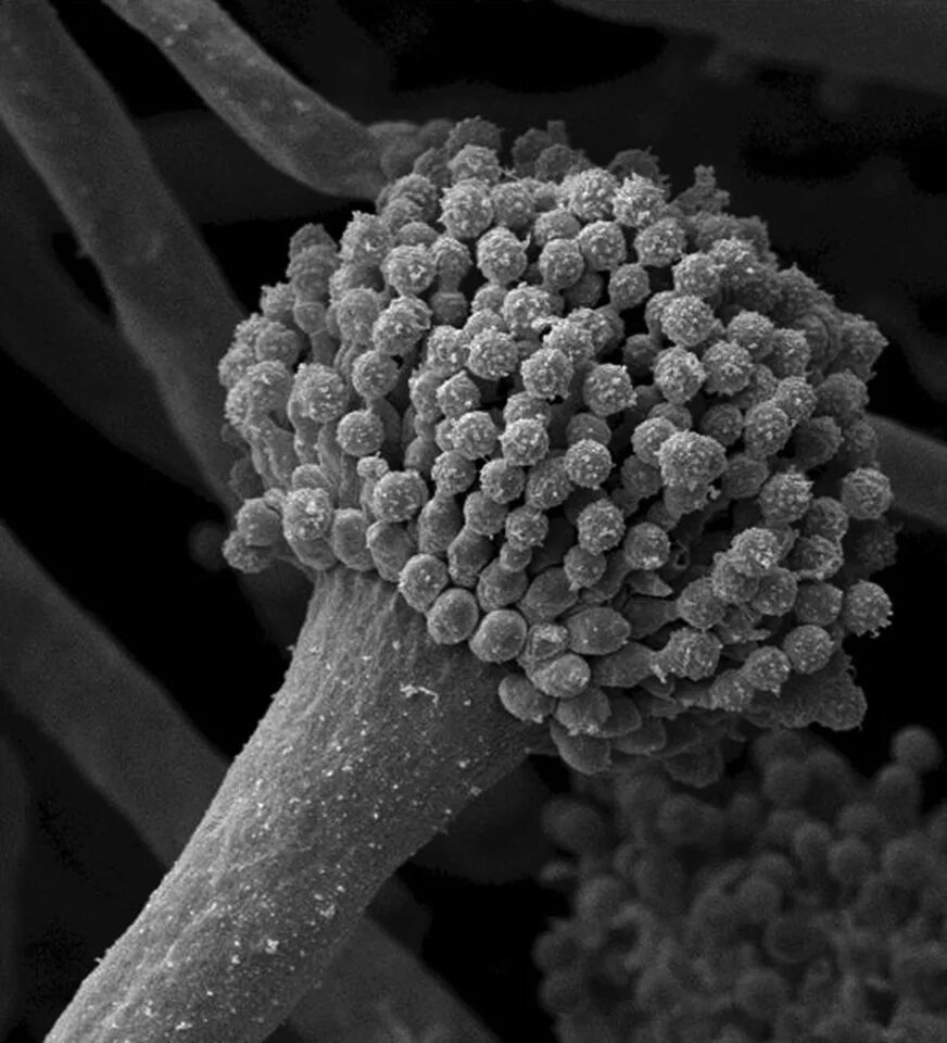 Грибы под микроскопом. Конидиеносец aspergillus. плесневые грибы аспергилл. аспергиллус флавус. грибы аспергиллус.