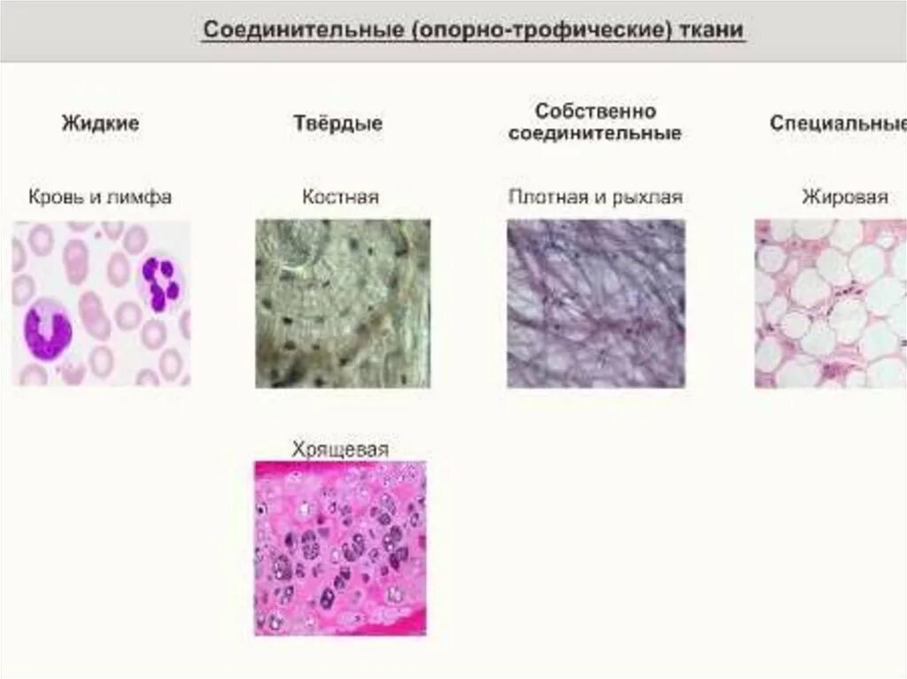 Ткань выполняющая опорную функцию организма. Строение соединительной опорной ткани. Классификация соединительной ткани человека. Опорно трофические ткани таблица. Классификация соединительной ткани опорно-трофическая.